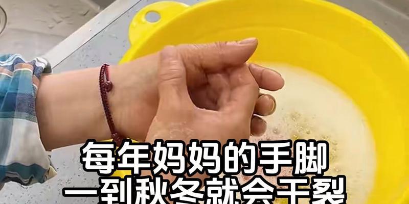 冬天手部开裂是什么原因？如何预防和治疗？  第2张