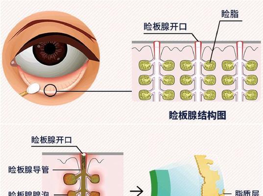 眼睛干涩最快的解决方法是什么？如何快速缓解眼部不适？  第2张