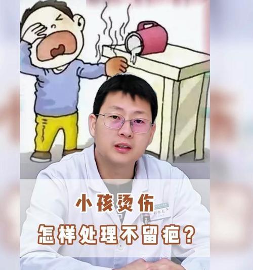 烫伤发生后如何正确处理？烫伤处理步骤有哪些？  第1张