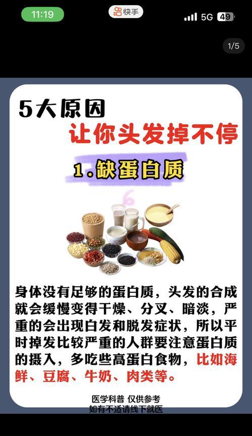 如何改善掉头发严重的问题？有效方法有哪些？  第1张