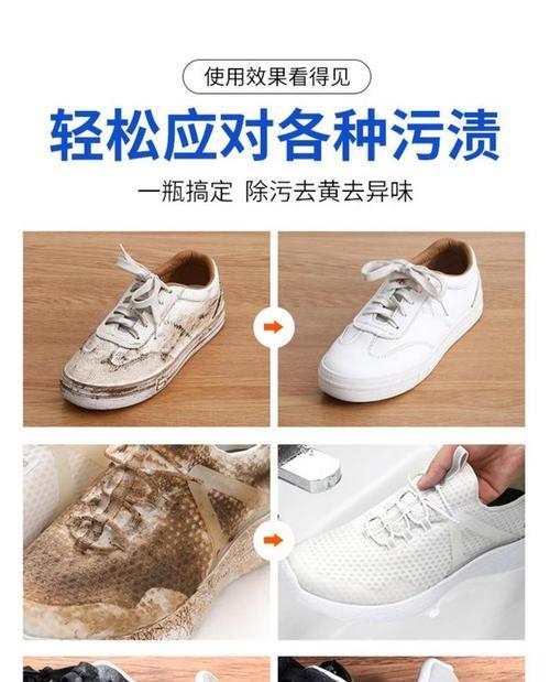 运动鞋边发黄变白妙招？如何轻松恢复鞋子原色？  第2张